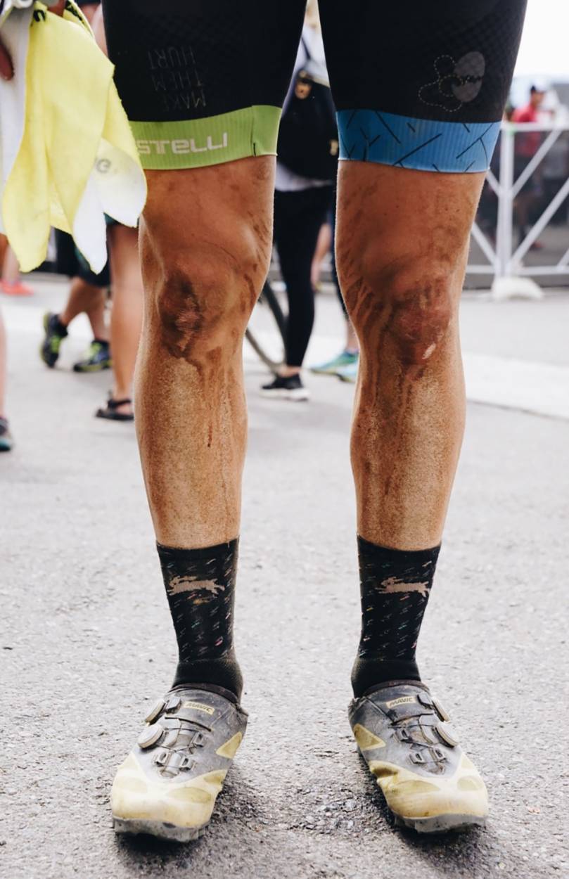 Leadville 100 Traildonkey